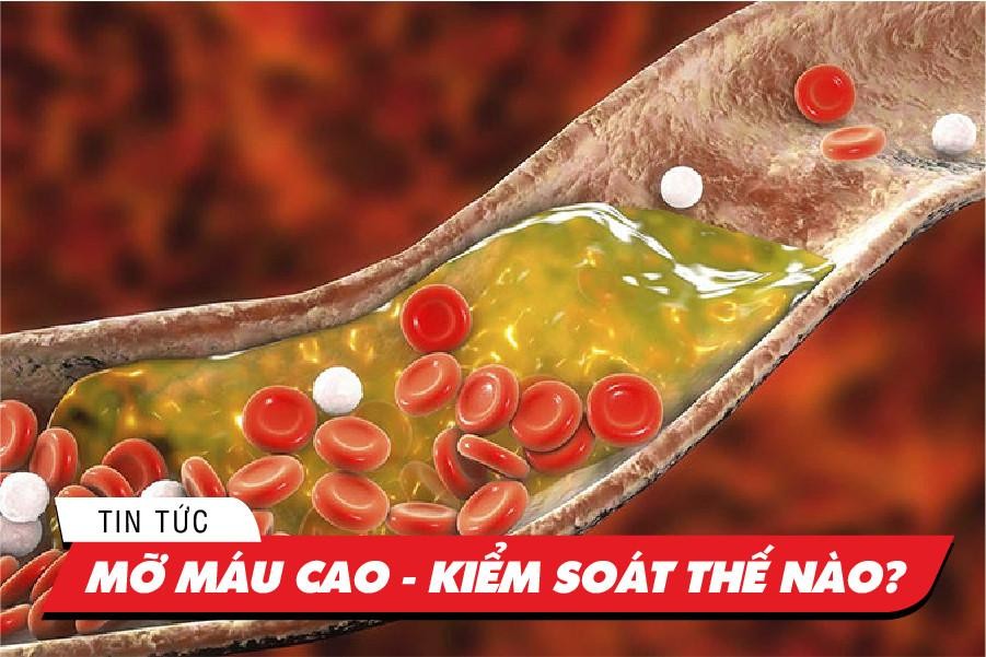 cách trị máu nhiễm mỡ tại nhà