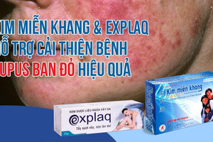 Cải thiện lupus ban đỏ nhờ bộ đôi Kim Miễn Khang & Explaq