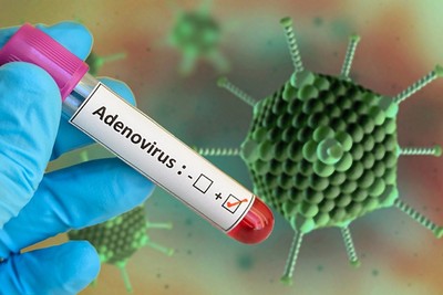 Adenovirus và những điều cần lưu ý