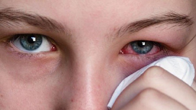 Phòng bệnh đau mắt đỏ