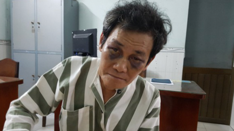 Bị can An bị người dân đánh bầm mắt sau khi bị phát hiện có hành vi dâm ô đối với cháu bé 7 tuổi