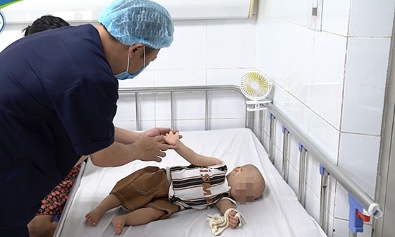 TS.BS Nguyễn Văn Lâm – Giám đốc Trung tâm Bệnh nhiệt đới, Bệnh viện Nhi Trung ương đang thăm khám cho trẻ mắc tay chân miệng. Ảnh: BVCC