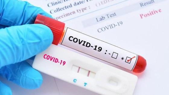 Người dân chỉ nên mua bộ kit test nhanh COVID-19 được công bố trên trang của Bộ Y tế. 