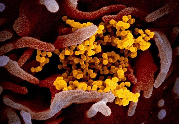 Hình ảnh dưới kính hiển vi điện tử cho thấy virus corona chủng mới (SARS-CoV-2, màu vàng) trên bề mặt các tế bào (màu hồng)