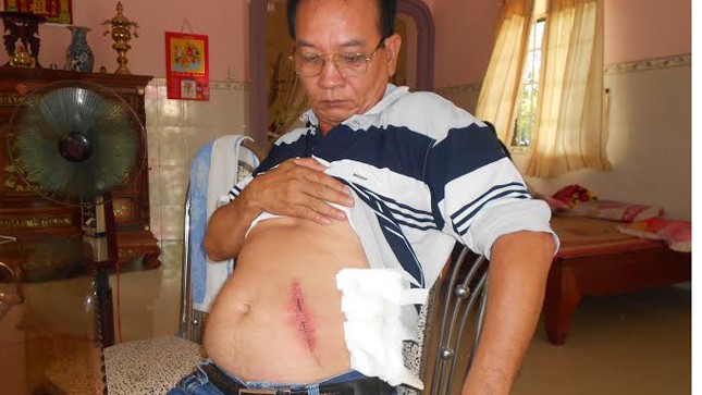 Ông Nguyễn Tấn Hưng bị thương ở bụng.