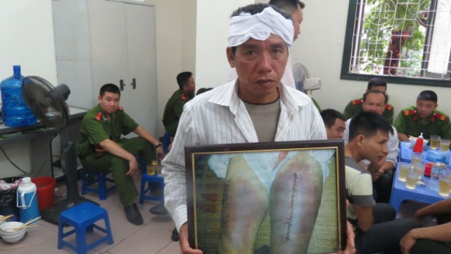 Em trai ông Thuận mang ảnh vết thương của nạn nhân đến phiên toà.
