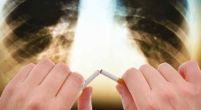 Căn bệnh hô hấp khiến 3 triệu người tử vong