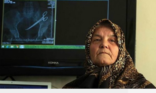 Hanim Ozgul và hình chụp X-quang cho thấy chiếc kéo nằm trong bụng bà. Ảnh: haberkita.com.