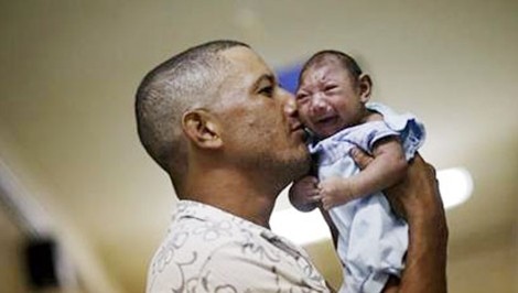 Trẻ mắc hội chứng teo não do virus Zika.