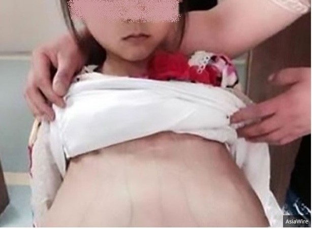 Hình ảnh bé gái trong phòng khám thai ở Trung Quốc
