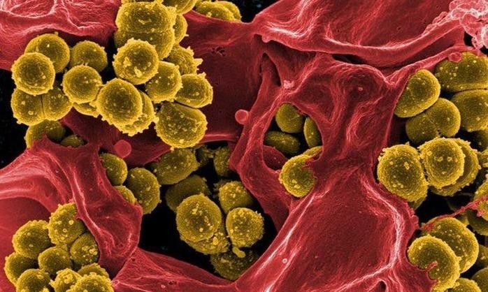 Hơn 350 học sinh bị ngộ độc sau bữa ăn bán trú: Vi khuẩn tụ cầu vàng nguy hiểm thế nào?