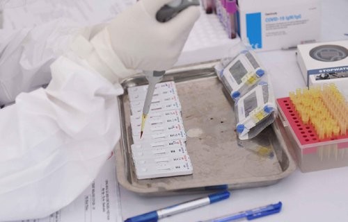Thêm 1 bệnh nhân ở Hà Nội tái dương tính với  SARS-CoV-2. sau 2 tuần ra viện