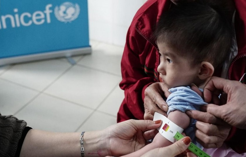 UNICEF kêu gọi các quốc gia tăng cường chính sách dinh dưỡng và tích hợp điều trị suy dinh dưỡng cấp tính ở trẻ em vào các chương trình y tế và ngân sách phát triển dài hạn. (Nguồn ảnh UNICEF Việt Nam)