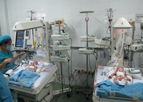 Cặp song sinh vừa được tách thành công ở Bệnh viện Nhi đồng 1
