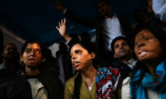 Những nạn nhân bị tạt axit tại Ấn Độ