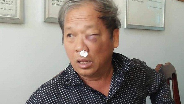 Nhà báo Hoàng Đình Chiểu bị hành hung dẫn tới nhiều thương tích.