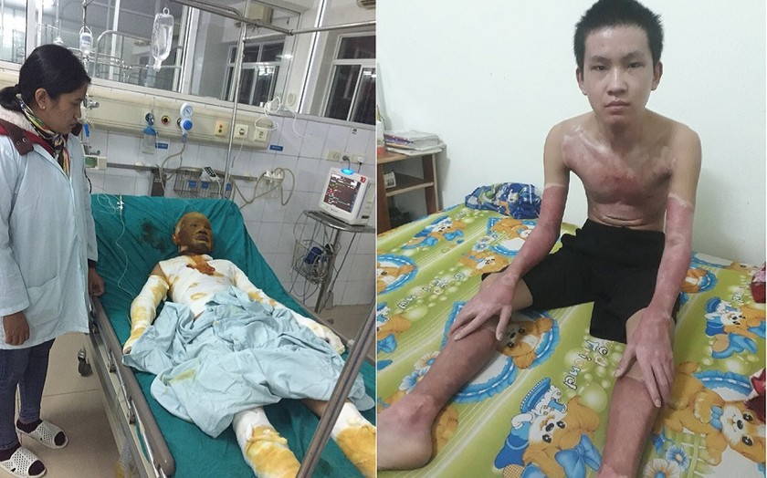Phan Anh Tuấn "hồi sinh" sau điều trị với sự đồng hành của tấm thẻ BHYT