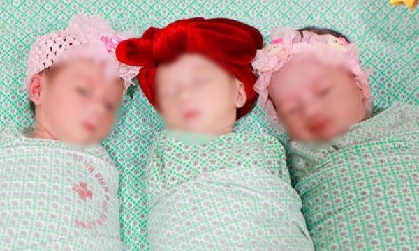 3 bé gái sinh cùng trứng hiếm gặp chào đời khỏe mạnh. Ảnh: BVCC