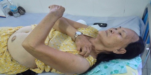 Bà Ấn đang nằm điều trị tại Bệnh viện Cam Ranh vì một số vết thương ở bụng, tay, đầu và cằm.