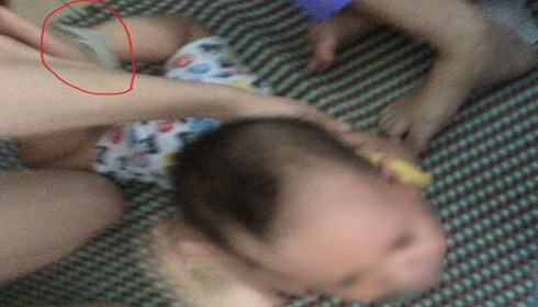 Hình ảnh cháu bé bị các cô giáo bạo hành tại cơ sở Sơn Ca (TP Đồng Hới)