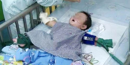 Bé Khang Khang, 7 tháng tuổi bị bác đầu độc bằng thủy ngân trong nhiệt kế tại nhà riêng ở Thành Đô, Trung Quốc.