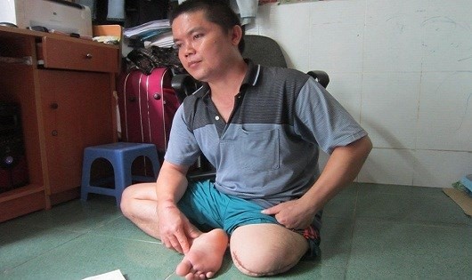 Anh Tài tố Bệnh viện huyện Nhơn Trạch không cho chuyển viện, khiến anh bị cưa chân.