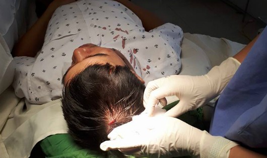 BS Nguyễn Văn Long đang được đồng nghiệp khâu vết thương do bị ném máy đo huyết áp vào đầu