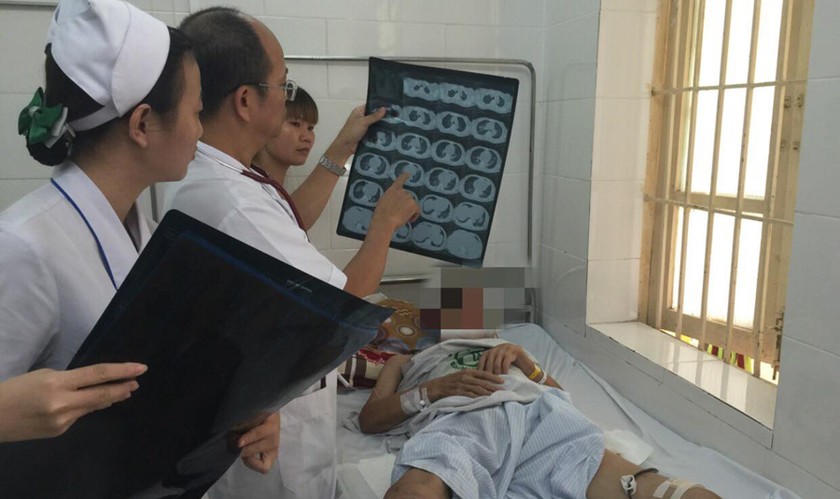 PGS.TS Đỗ Duy Cường thăm khám cho bệnh nhân S. Ảnh: Bệnh viện Bạch Mai.
