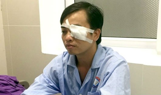 Bác sĩ Trần Văn Sơn phải điều trị chấn thương nặng vùng mắt do bị hành hung