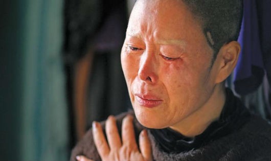 Kim Bok-soon chỉ là một trong số các nạn nhân của phẫu thuật thẩm mỹ thất bại.