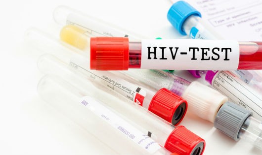 Cách tốt nhất phát hiện HIV, cứu cả bản thân và người khác