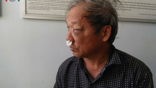 Nhà báo Hoàng Đình Chiểu – Phóng viên VTV, thường trú tại tỉnh Kon Tum - bị nhóm côn đồ tấn công. Ảnh VOV