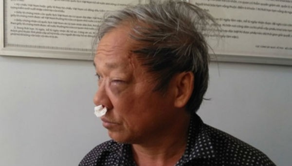 Nhà báo Hoàng Đình Chiểu – Phóng viên VTV, thường trú tại tỉnh Kon Tum bị hành hung.