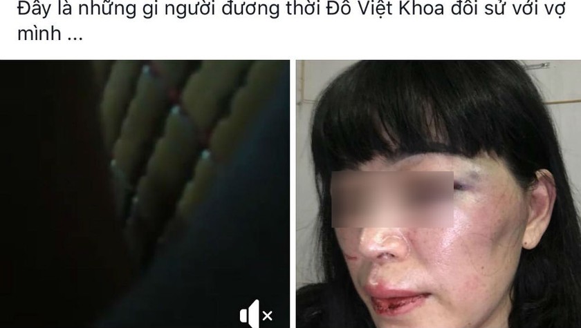 Thực hư thông tin 'Người đương thời' Đỗ Việt Khoa đánh vợ
