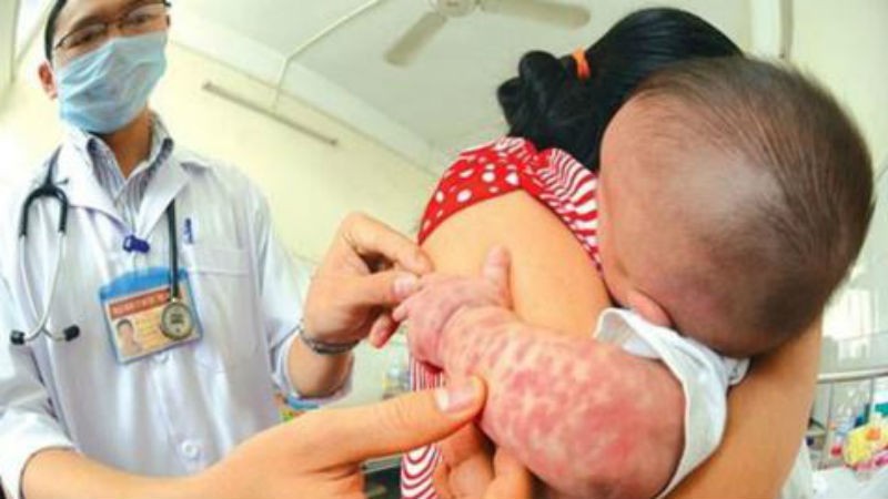 Nói không với vắc xin, cha mẹ đã khiến sinh mệnh trẻ bị đe dọa.