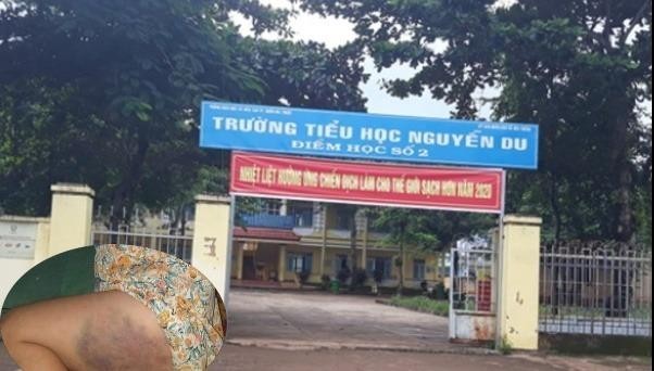 Trường tiểu học Nguyễn Du nơi xảy ra việc đánh học sinh.