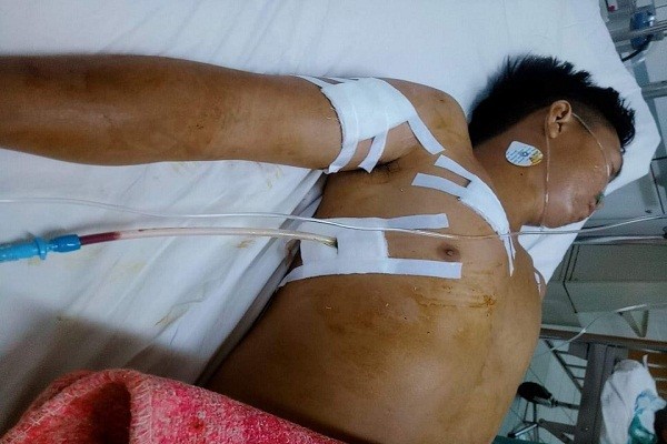 Nạn nhân Nguyễn Lầm đang được điều trị tại bệnh viện (ảnh C.Định)
