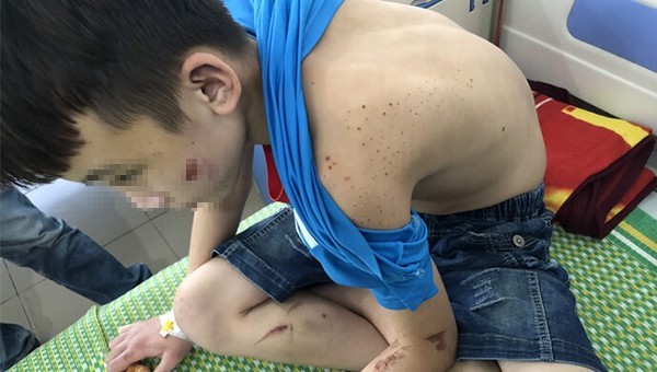Hình ảnh cậu bé Quang Duy bị chủ quán bánh xèo tại Bắc Ninh "tra tấn" gây bức xúc dư luận những ngày qua.