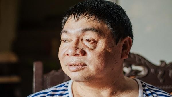 Cựu binh Nguyễn Văn Thống, 1 trong 9 người bị Trung Quốc bắt giữ.