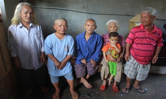Các thành viên trong gia đình nhiều người lùn nhất Việt Nam.
