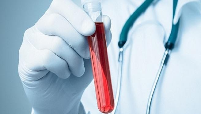 Xét nghiệm máu có thể biết 10 năm nữa bạn còn sống hay không? 