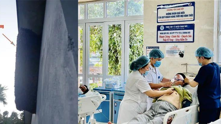 Bệnh nhân bị ong đốt được điều trị tại Khoa Cấp cứu, Hồi sức tích cực và Chống độc Trung tâm Y tế huyện Thanh Thủy. Ảnh: Sở Y tế tỉnh Phú Thọ.