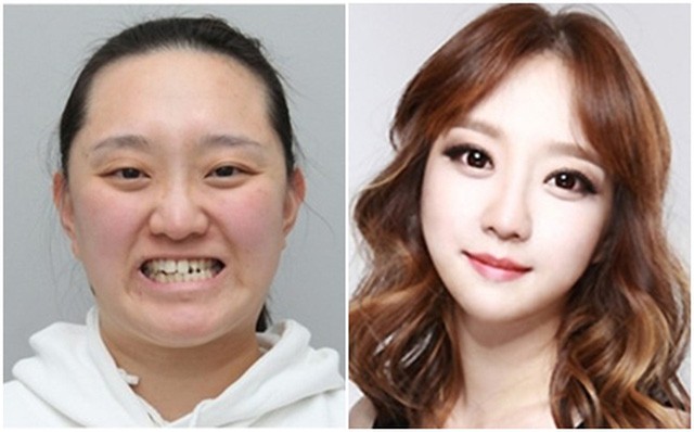 1001 chuyện trong ngành thẩm mỹ (Kỳ 2): Áp lực phải trở nên xinh đẹp ở Hàn Quốc