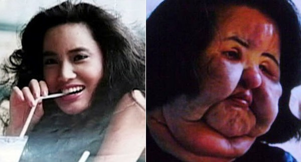Nữ diễn viên Han Mi Ok qua đời ở tuổi 57 bà là thảm họa của ngành phẫu thuật thẩm mỹ của Hàn Quốc.