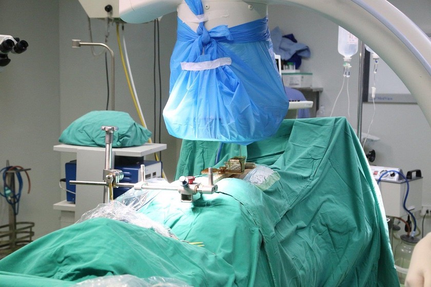 Bệnh viện Đa khoa tỉnh Phú Thọ ứng dụng công nghệ mổ robot trong phẫu thuật cột sống