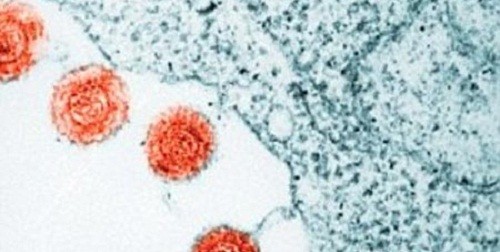 Các nhà khoa học Anh đã tìm được cách lợi dụng virus herpes để tiêu diệt các tế bào ung thư da từ bên trong. Ảnh minh họa: Corbis