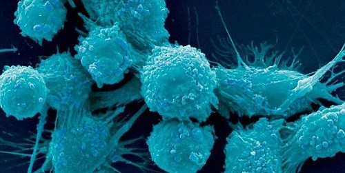 Phân tử DNA-PKcs được phát hiện giữ vai trò then chốt trong việc kích hoạt các khối u ung thư di căn khắp cơ thể. Ảnh minh họa: Corbis