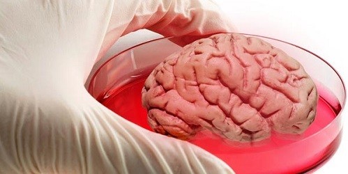 Bộ não người mini, nhân tạo được cho là mang tới một mô hình thử nghiệm thuốc và tìm hiểu về các bệnh não tốt hơn sử dụng não động vật như hiện nay. Ảnh minh họa: Discovery