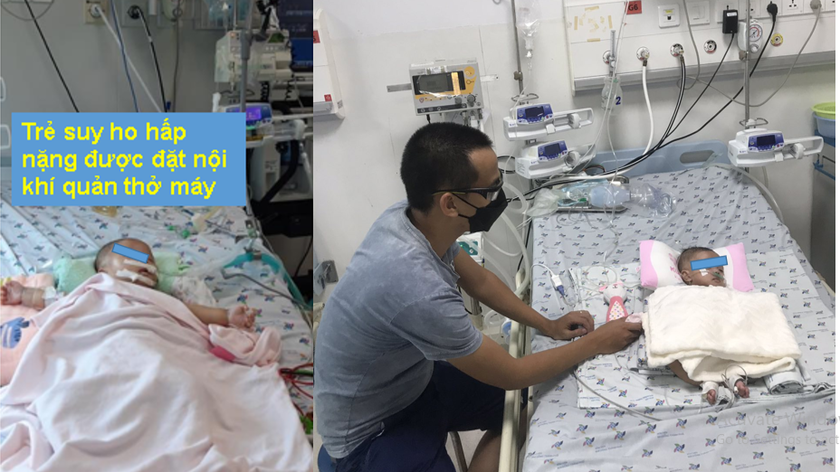 Bệnh nhi P. N. T. V. nữ 3 tháng tuổi, bị COVID-19, suy hô hấp nặng phải thở máy, được cai máy thở sau hơn 1 tháng điều trị. Ảnh: BVCC