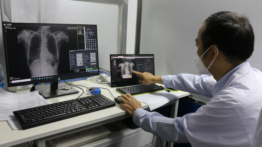 Các bác sĩ sử dụng X-quang ngực trong khám sàng lọc để phát hiện lao phổi. Ảnh: Ngọc Nga